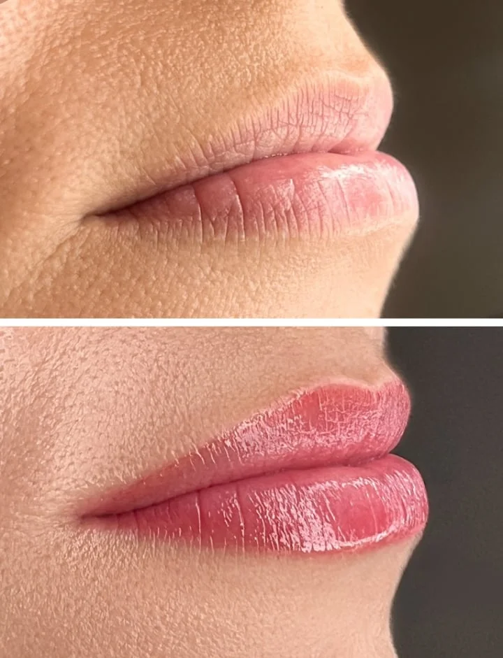 Beispielbild: Lippen im Vergleich
