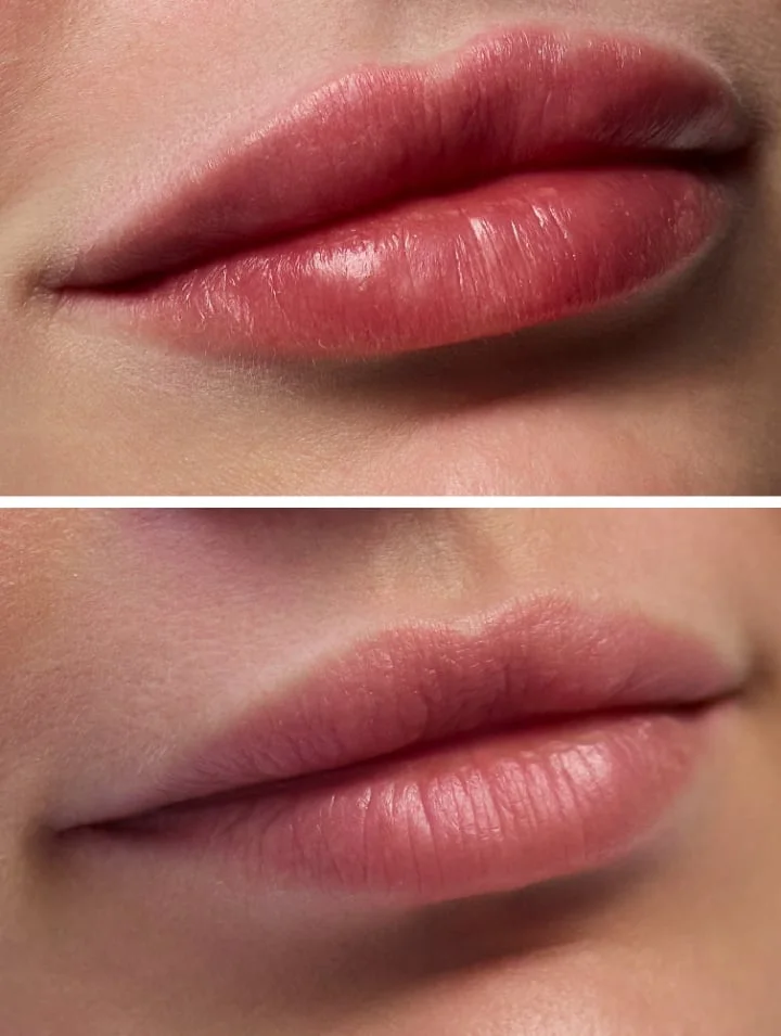 Beispielbild: Lippen im Vergleich