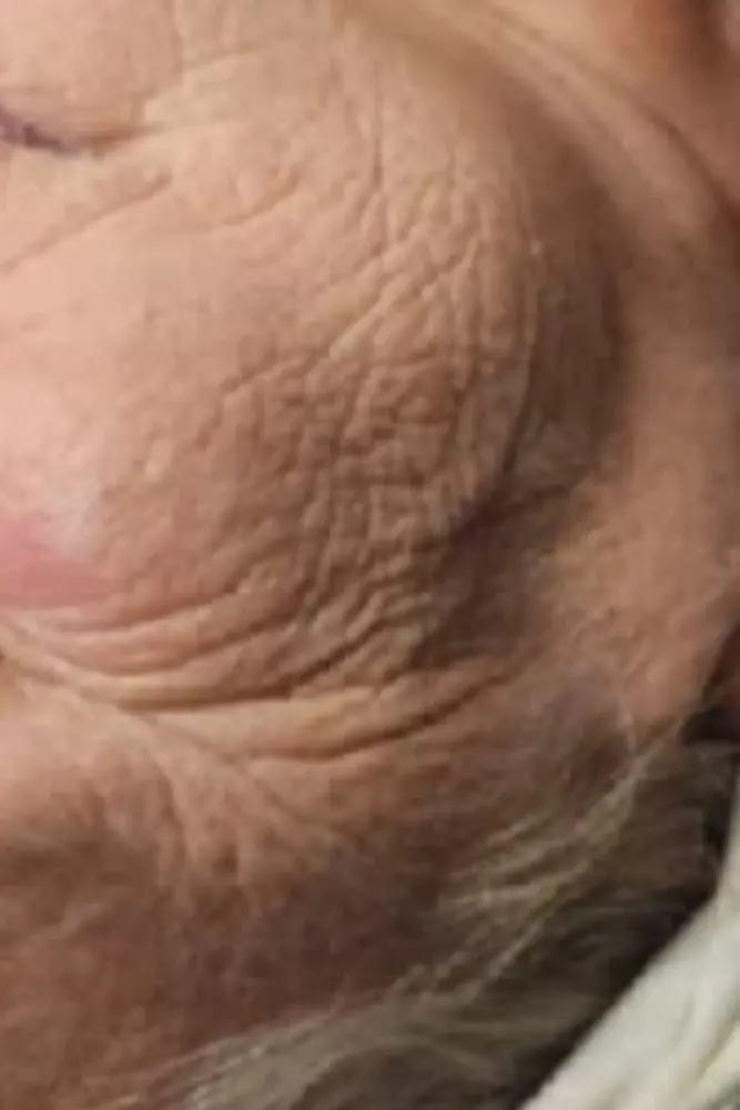 Gesichtshaut, Ausgangszustand